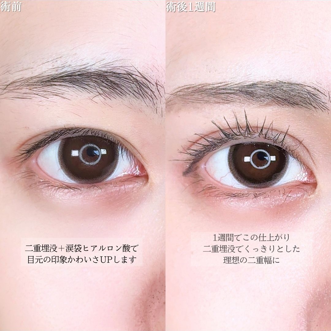 No.16559の症例写真1